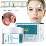 Hertik™ Acne Treatment Face Cream